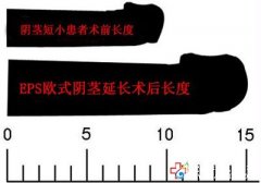 為什么陰莖那么短？應該