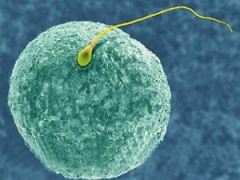 石河子抗精子抗體治療費用是多少？