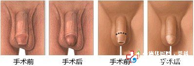 九江做包皮哪家醫院好 九江做包皮哪家醫院好